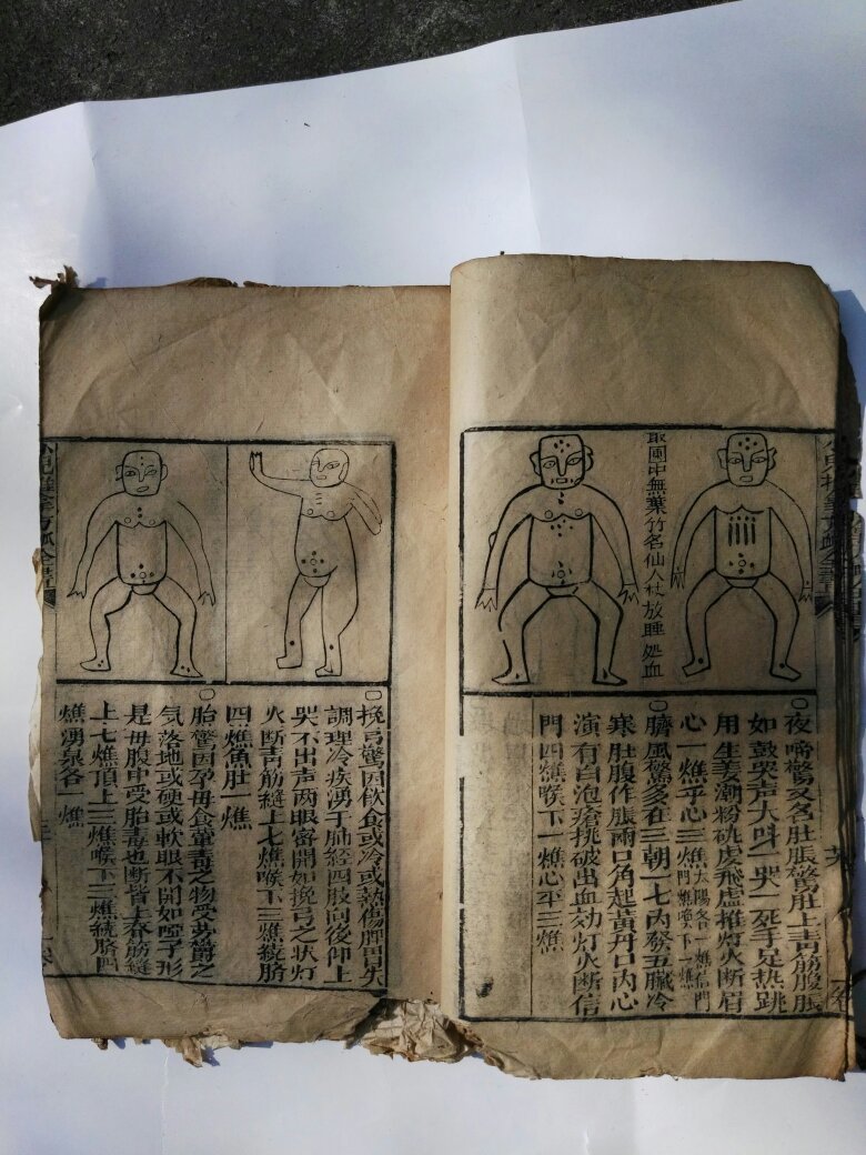 小儿推拿方法全书