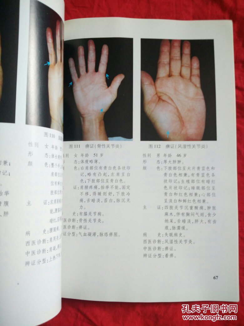 中医手诊图释