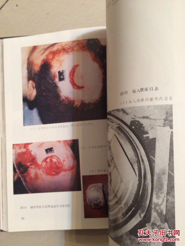 大专有法医学(有法医学专业的专科大学)