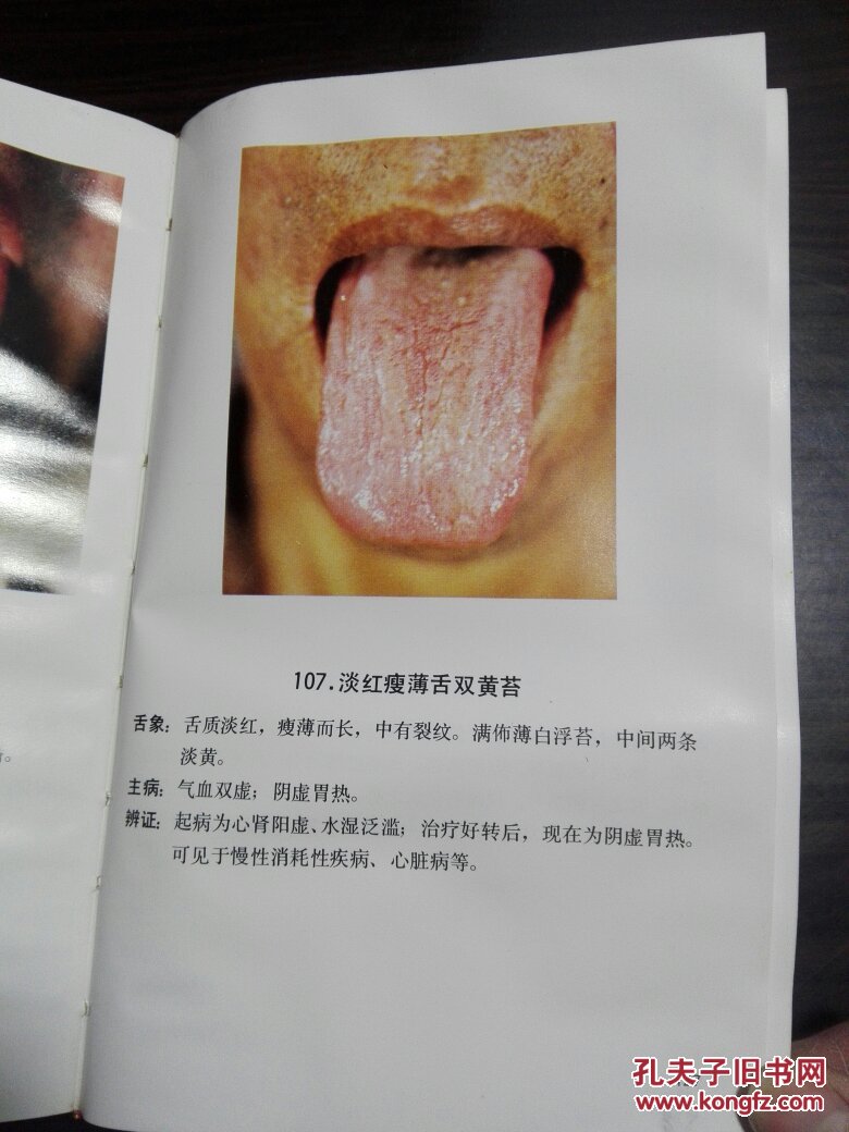 中医舌苔图谱(宋天彬著 共257张实拍舌苔彩图