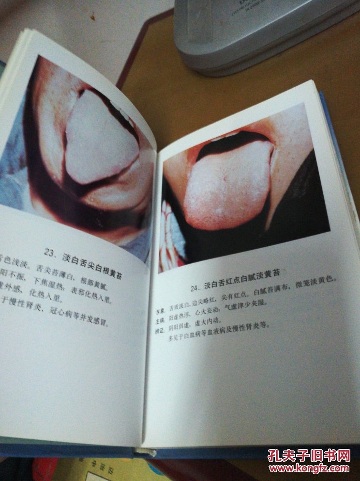 中医舌苔图谱