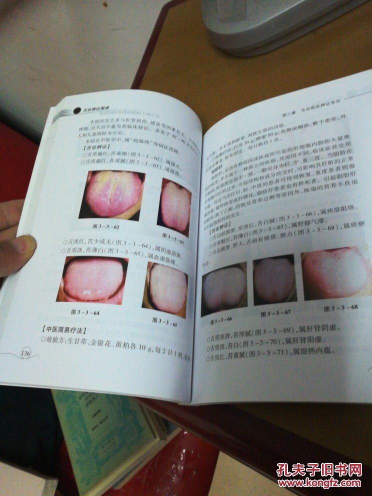舌诊辨证图谱第二版彩图本