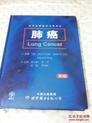 肺癌（第3版）