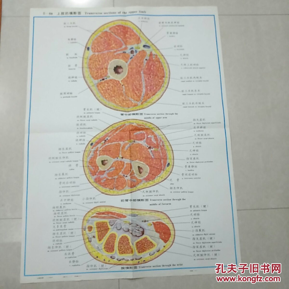 人体解剖挂图lx一50上肢的横断面