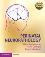 预订 Perinatal Neuropathology 围产期神经病理学，英文原版