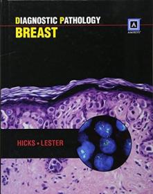 Diagnostic Pathology: Breast: Published by Amirsys (R)