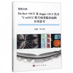 En face-OCT及Angio-OCT技术与mGCC相关病变临床病例应用思考