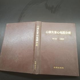 心律失常心电图分析