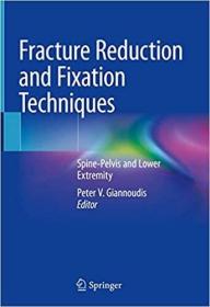 英文原版 高被引图书Fracture Reduction and Fixation Techniques: Spine-Pelvis and Lower Extremity