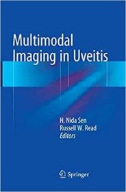 英文原版 高被引图书Multimodal Imaging in Uveitis