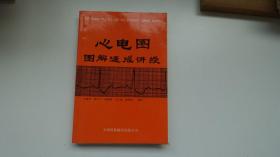 心电图图解速成讲授