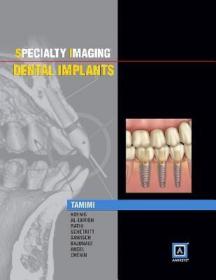 现货 Specialty Imaging: Dental Implants (Specialty Imaging)[9781937242190]