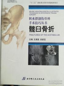 髋臼骨折——积水潭创伤骨科手术技巧丛书