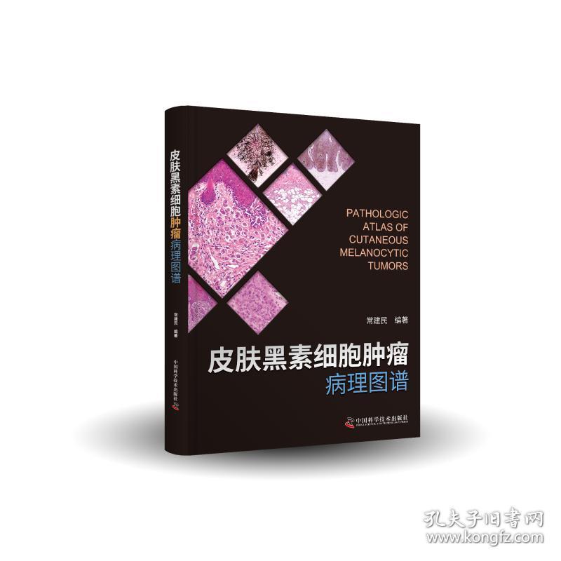 皮肤黑素细胞肿瘤病理图谱 孔夫子旧书网