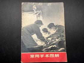 《常用手术图解》1971年上海人民出版社出版