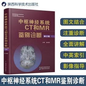 中枢神经系统CT和MR鉴别诊断