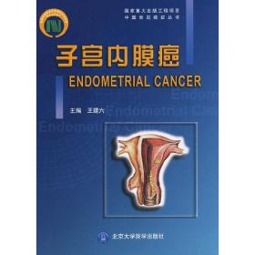 子宫内膜癌（中国常见癌症丛书）