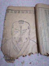 清代或清代以前木刻中医典籍一本带很多珍贵插图，珍本罕见保真！。品相如图有残损请自鉴，资料很珍。