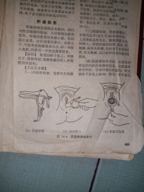 文革32开上海版《赤脚医生手册》（看图和描述）
