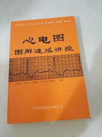 心电图图解速成讲授