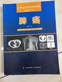 实用临床影像诊断图谱：肺癌（第2版）
