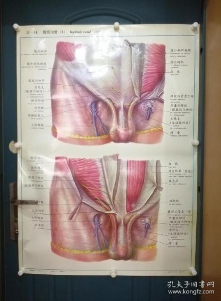 人體解剖掛圖：Ⅸ―18  腹股溝管（1）