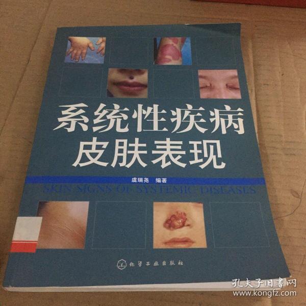 系统性疾病皮肤表现