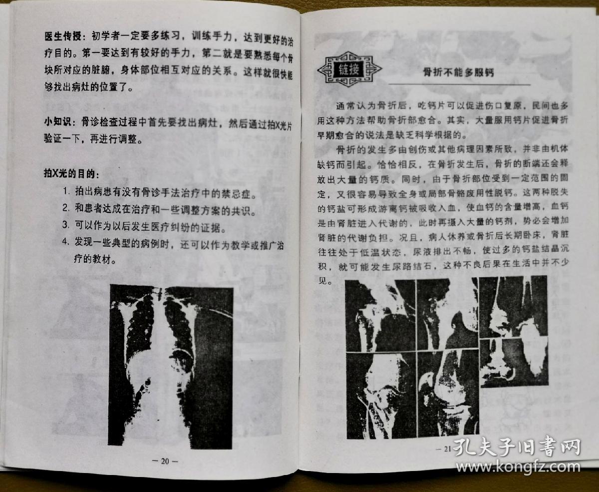 骨疗摸骨知病书著名骨诊专家主讲示范刘鳌vcd光盘2盘