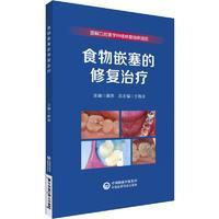 新华正版 食物嵌塞的修复治疗（图解口腔美学种植修复临床规范） 于海洋 9787521437690 中国医药科技出版社