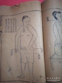 清代光绪年京都泰山堂藏版木刻线装本（绘图外科正宗）4册12卷全【残本】书内有木刻绣像插图，稀有的中医古籍善本，。带中医方剂等。!。。，。