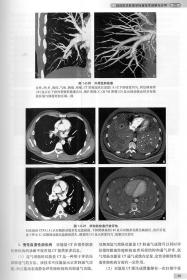 现货 中华影像医学 呼吸系统卷 第3版三 配增值 影像医学参考书 刘士远 郭佑民 人民卫生出版社