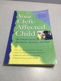 Your Cleft-Affected Child