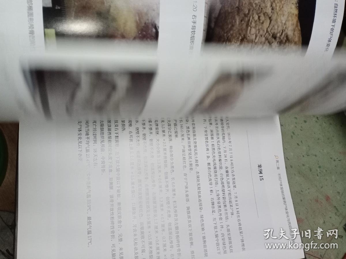 尸变图鉴:自然环境下的尸体变化(陈禄仕,法医专业书籍)_陈禄仕_孔夫子旧书网