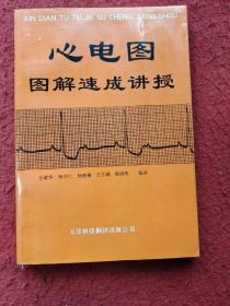 心电图图解速成讲授