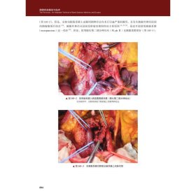 胰腺疾病基础与临床 原书第3版 典藏版