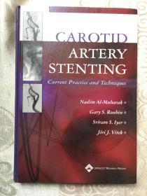 carotid artery stenting