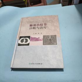 肺部小结节诊断与治疗