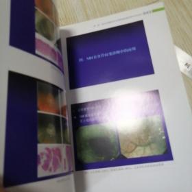 消化内镜切除术  铜版纸彩印 书脊磨损如图有胶带纸，实物拍图品相自鉴