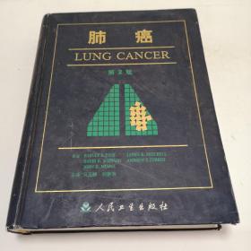 肺癌第2版。