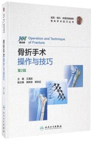 骨折手术操作与技巧(第2版)(精)/骨科手术技巧丛书