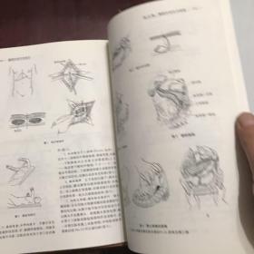 腹部外科手术技巧