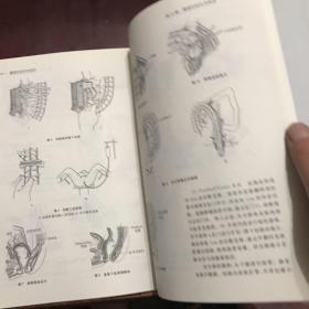腹部外科手术技巧
