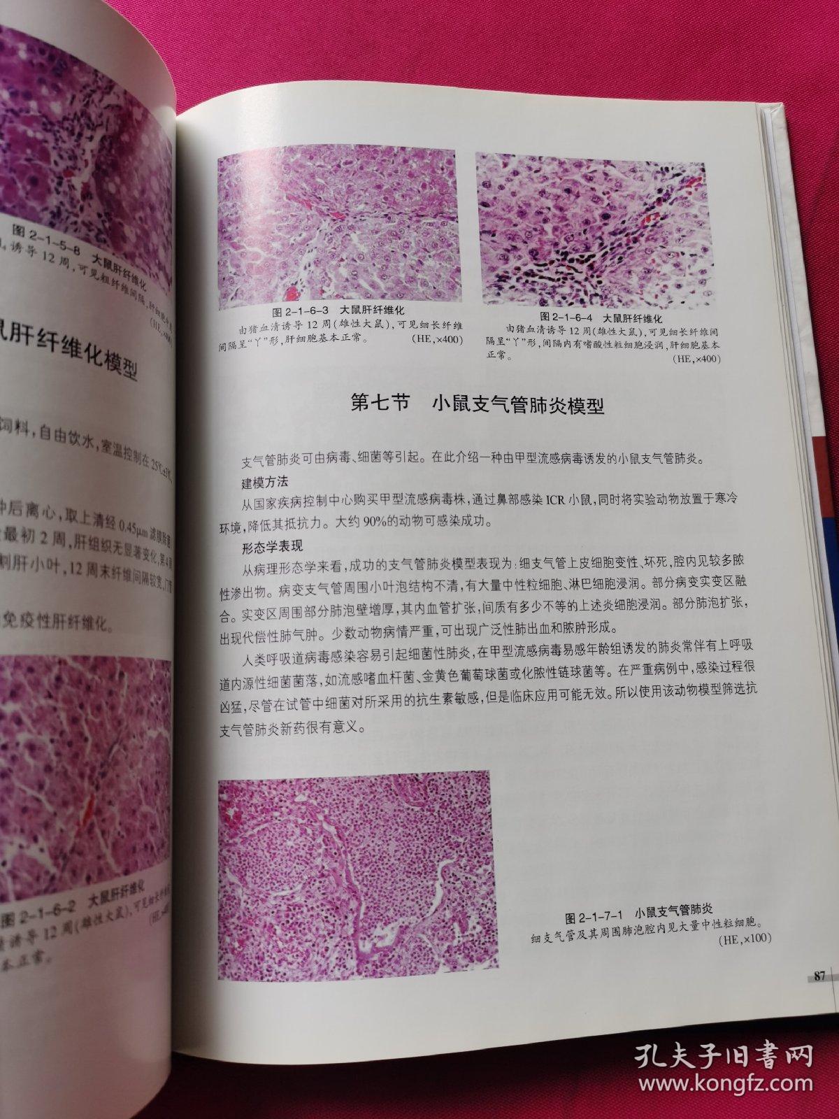 【衡道丨干货】原著摘录：胃肠道早期黏膜肿瘤的组织病理学（上篇）