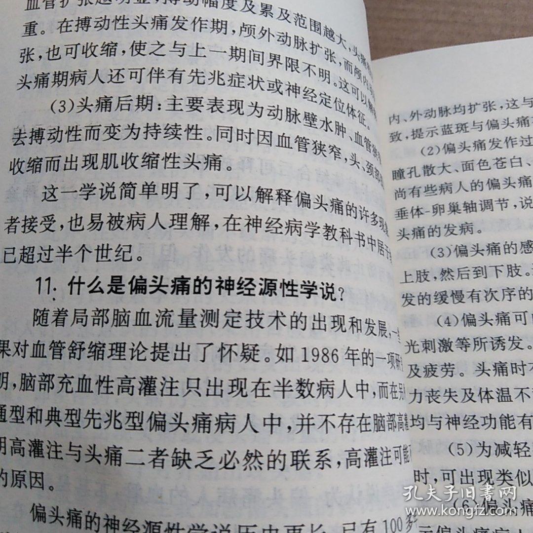 偏头痛要去医院看吗 这次来的有点猛 篱笆社区手机版
