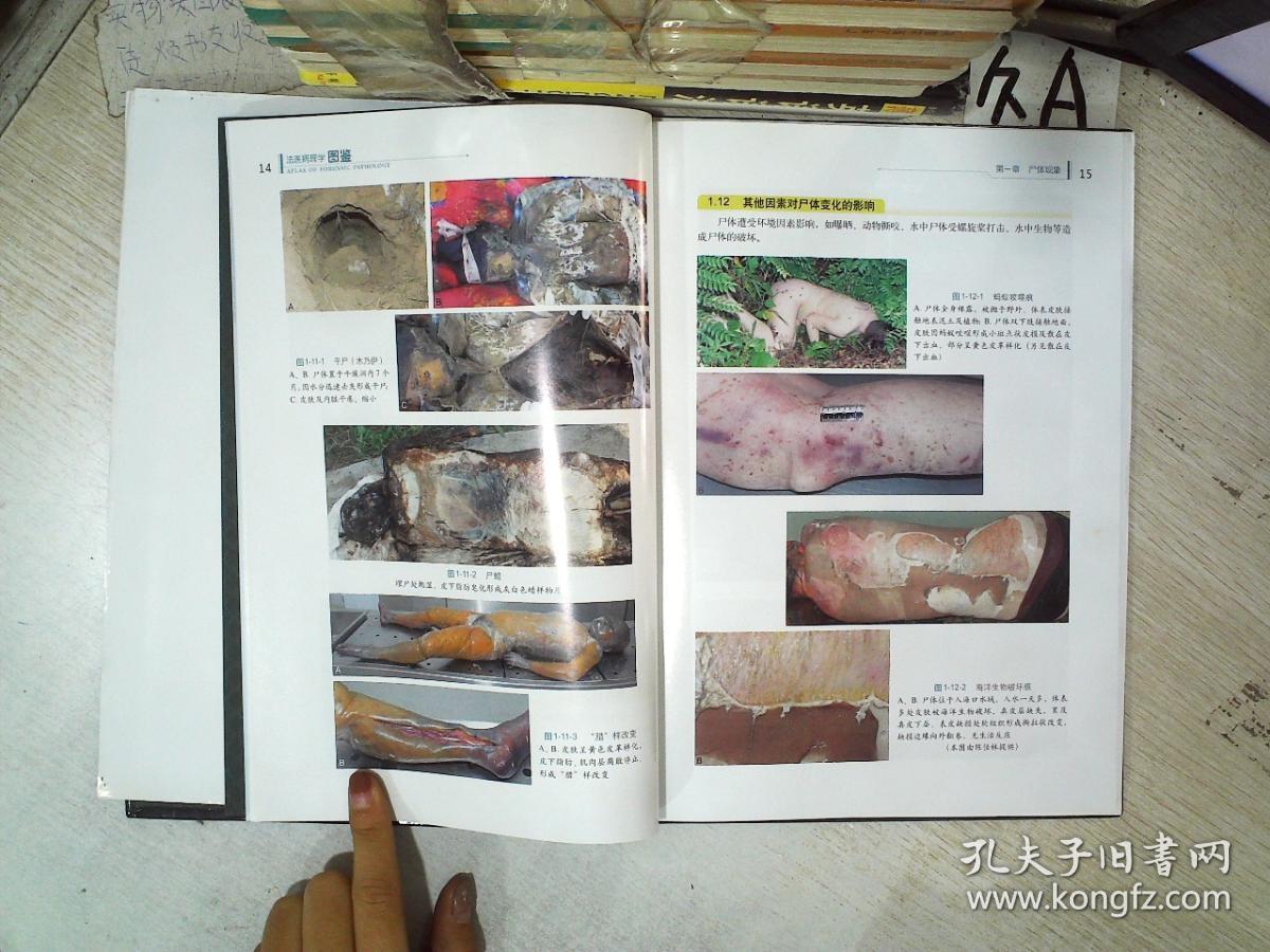 法医病理学图鉴
