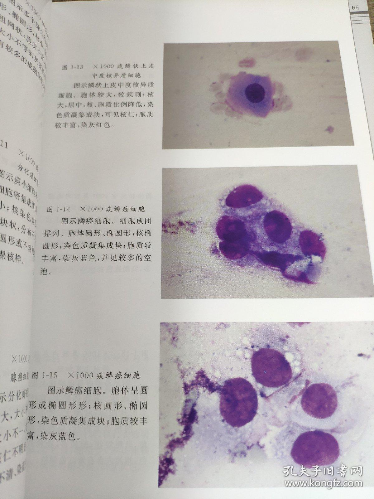 临床脱落细胞学图谱分析及诊断 李元堂,张炳昌 编 第1-3章