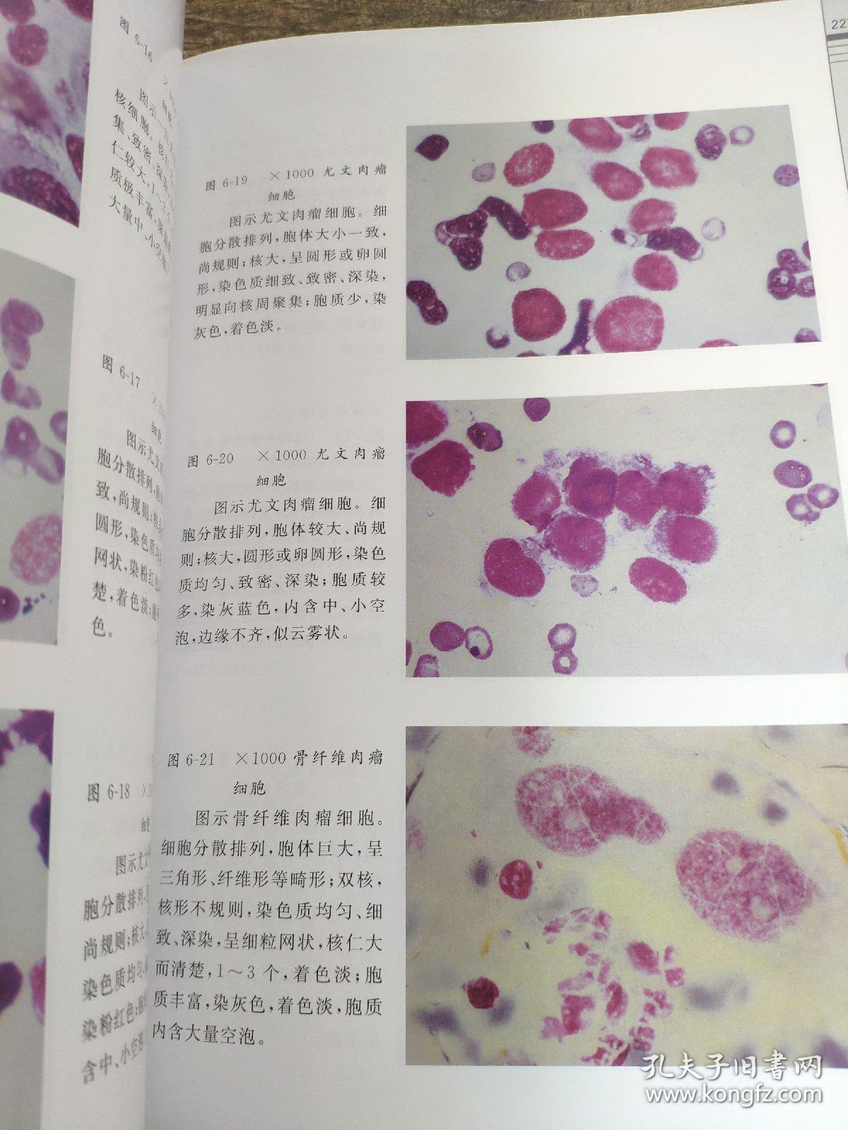 临床脱落细胞学图谱分析及诊断    李元堂,张炳昌