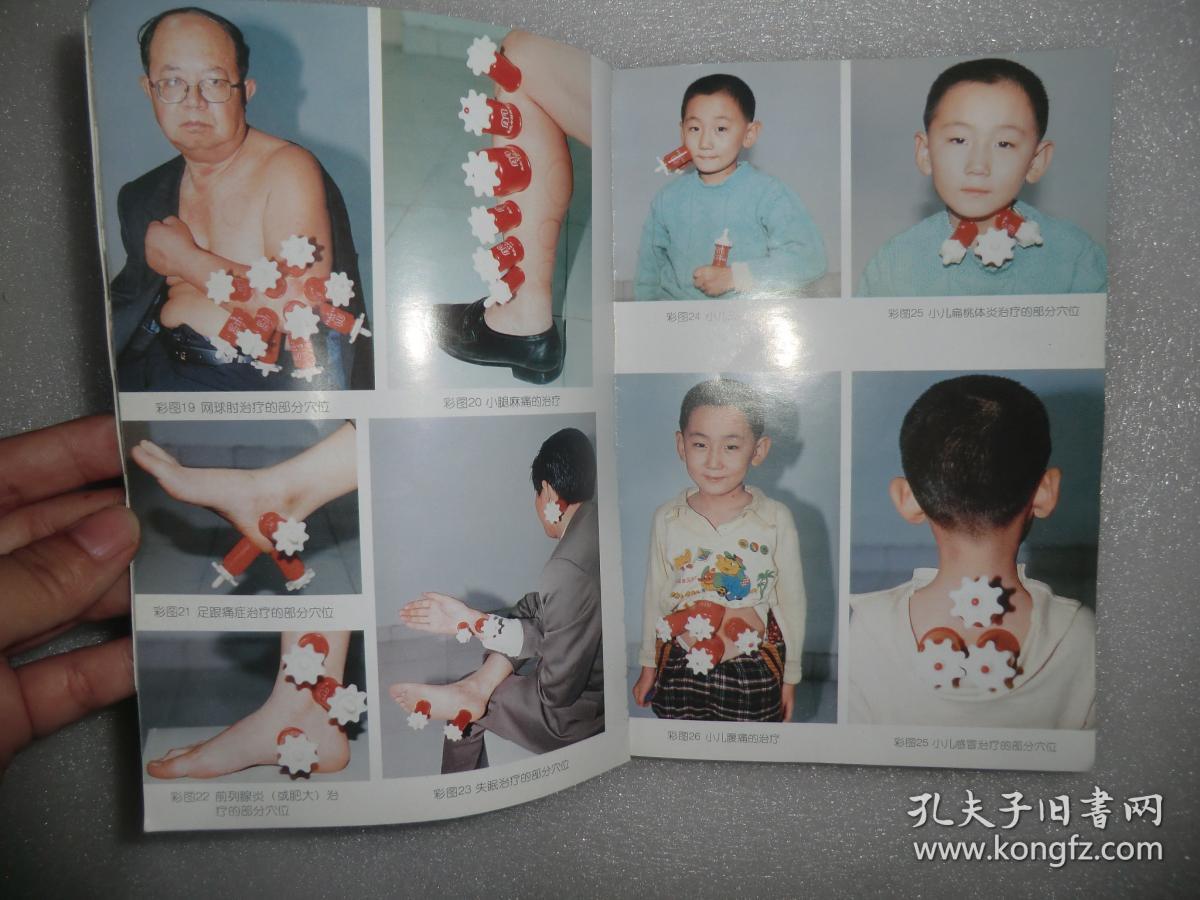 孟氏中药拔罐疗法 孟宪忠 主编 c1967