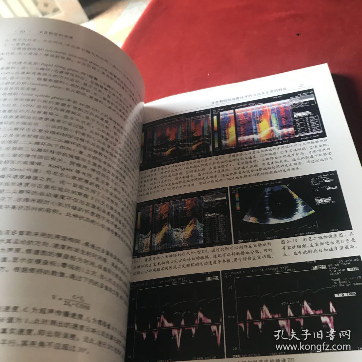 多普勒组织成像