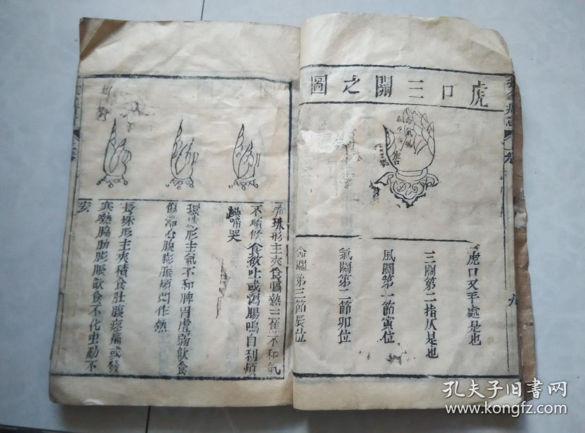 育婴第一善本 小儿推拿广意 (卷上一册全)